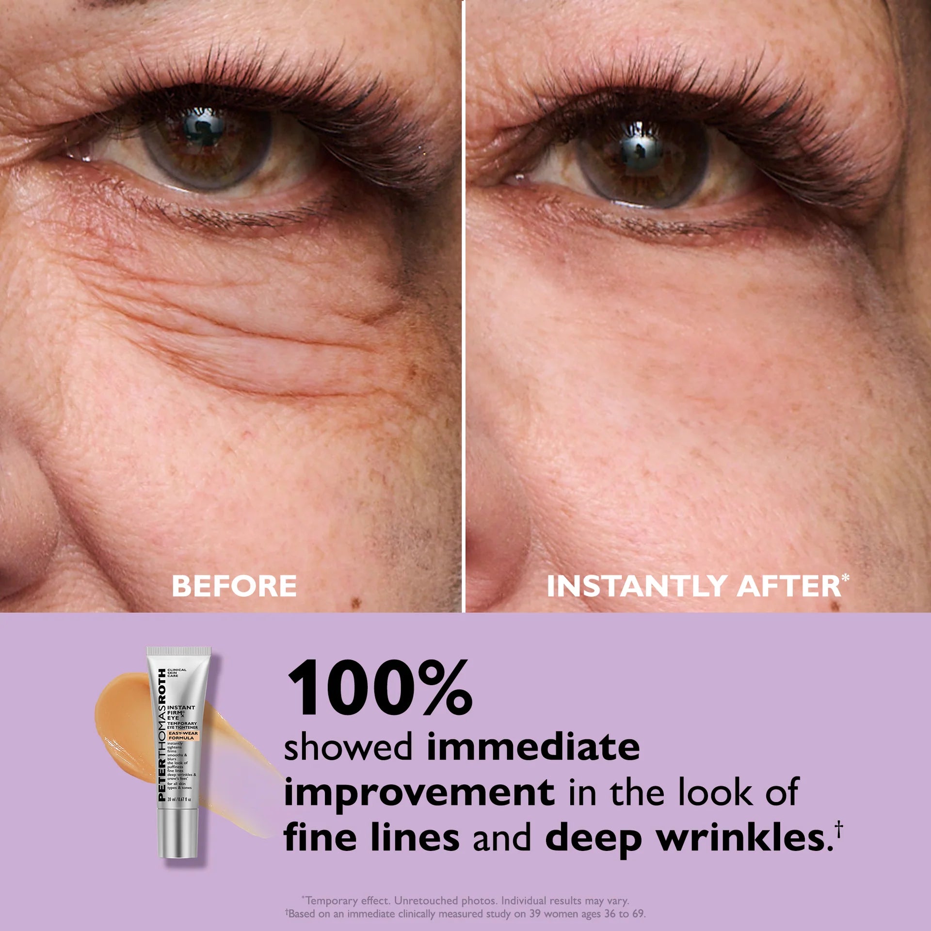 Peter Thomas Roth | Instant FIRMx® Eye Temporary Eye Tightener Easy-Wear Formula | For Firming Under-Eye Bags & Wrinkles